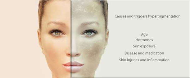 External factors that effect the health of skin